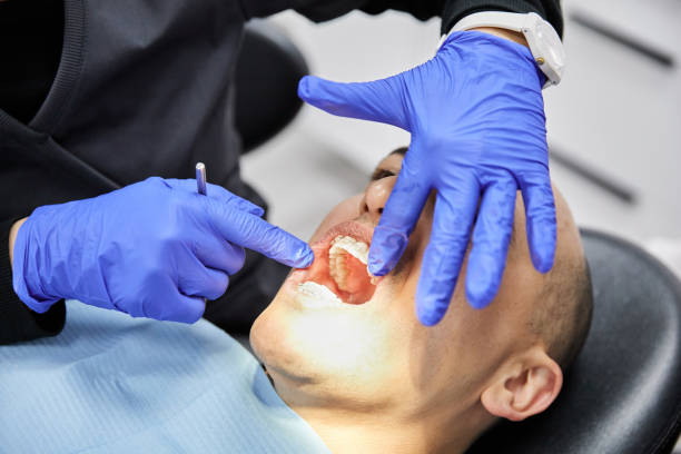 Best Emergency Tooth Extraction in Stuart, FL
